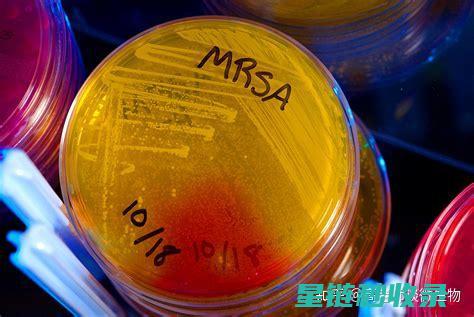 如何有效去除衣物上的墨水渍：实用步骤大揭秘 (如何有效去除黑头)